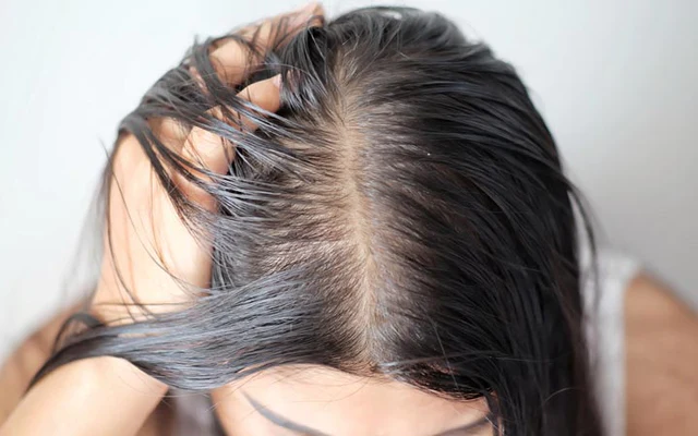 best dry shampoos for oily hair